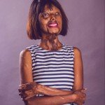 WOMAN SHARES INSPIRING STORY OF HOW SHE WAS DOUSE IN ACID BY HER FATHER BECAUSE HE WANTED A MALE CHILD