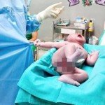 FEW SECONDS AFTER BEING BORN, BABY GRABS DOCTOR’S SHIRT AND REFUSE TO LET GO
