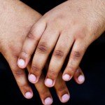 3 HOME REMEDIES TO GET RID OF DARK KNUCKLES
