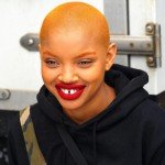 MODEL SLICK WOODS REVEALS SHE HAS STAGE 3 MELANOMA CANCER