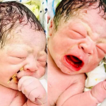 Baby Is Born Holding His Mother’s Contraceptive Coil That Was Supposed To Stop Her From Getting Pregnant