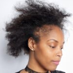 4 Natural Ways To Treat This Condition