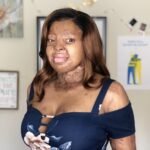 Kechi Okwuchi: Plane Crash Survivor, Bullying Prevention Advocate, And Songwriter